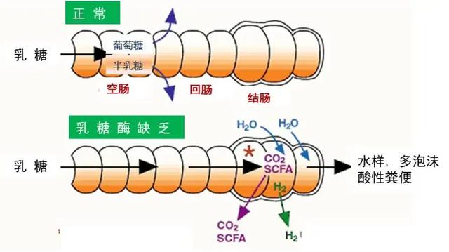 乳糖不耐受宝宝最常见的症状有哪些？插图