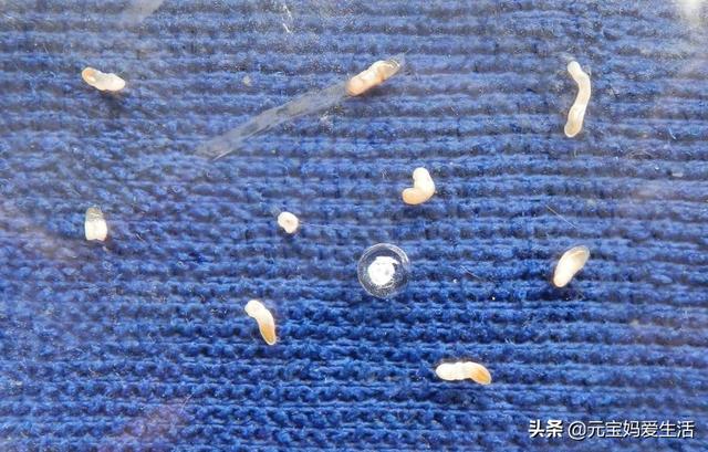 萧亚轩公开意外受伤照片:为什么动物吃生肉不会生病，但是一受伤却容易感染造成死亡