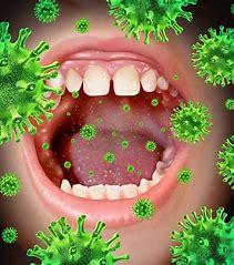 头条问答 扁桃体结石是什么病 要紧吗 24个回答