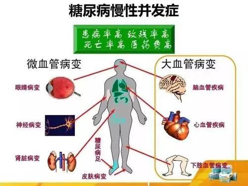 布病终身携带一辈子痛苦:你觉得最令人痛苦生不如死的疾病是什么？为什么？