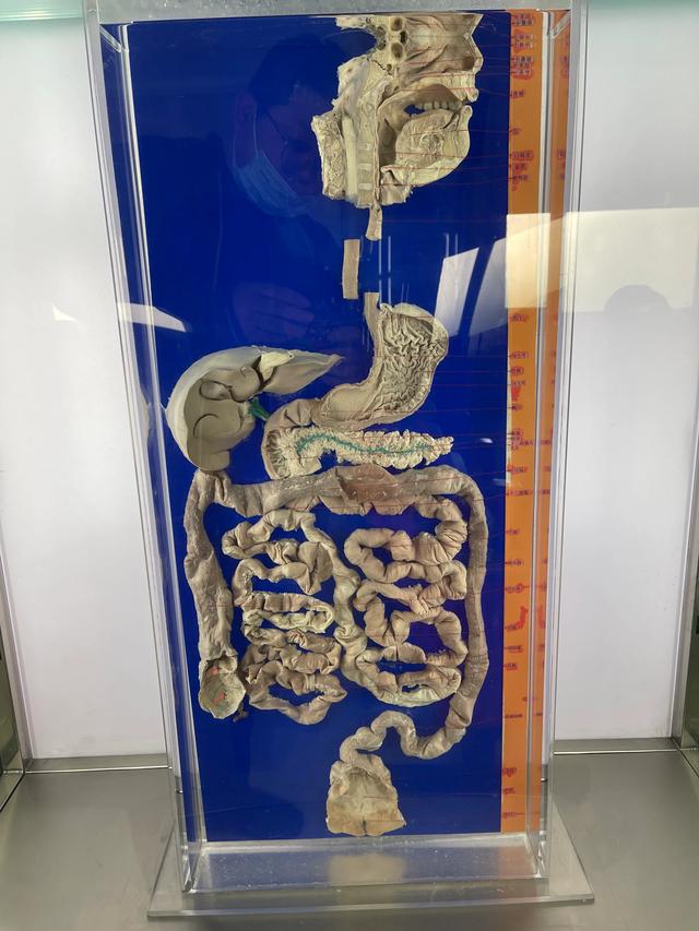 福尔马林人体器官图片