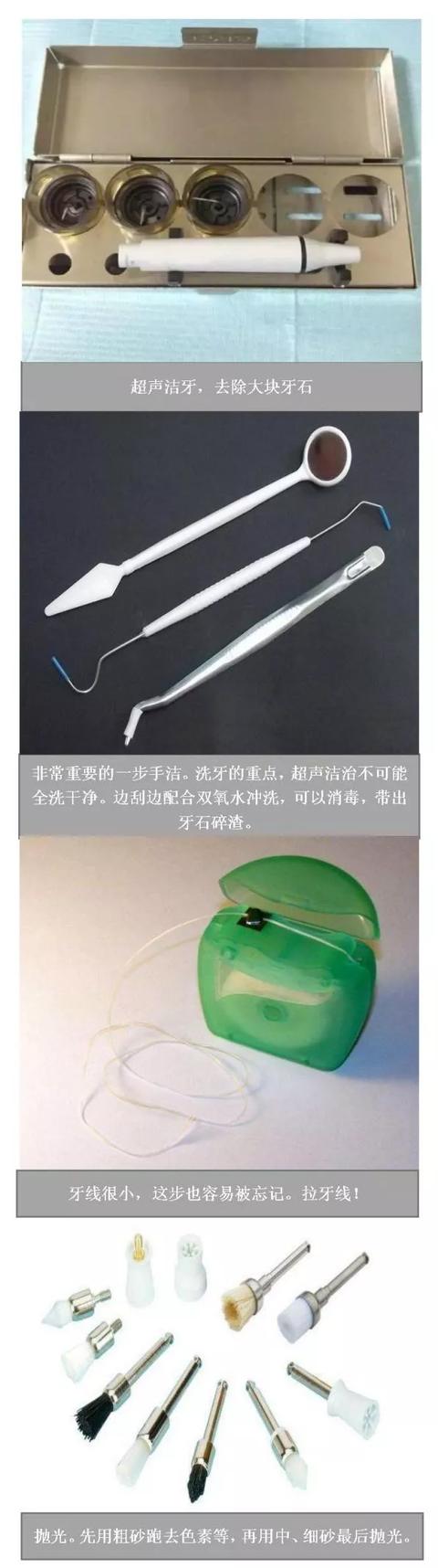 洗牙之前必须吃早餐吗:洗牙之前必须吃早饭吗 洗牙的过程是什么样的，洗完之后感觉如何？