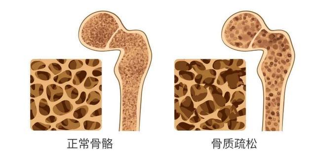 哥伦比亚号失事:宇航员去太空回来后身体通常会发生什么变化？