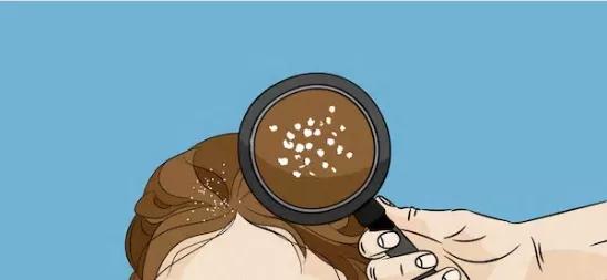 头条问答 - 头皮屑超多,洗不干净怎么办?(28个回答)