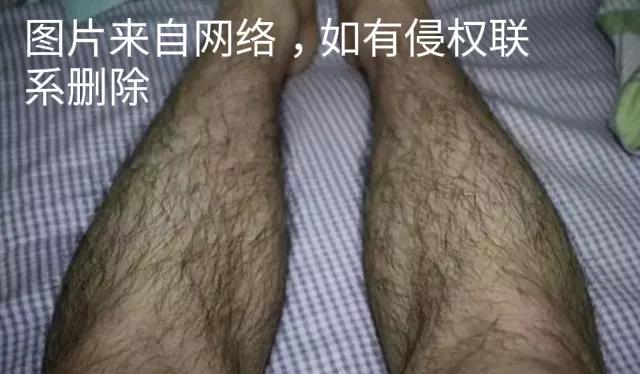 头条问答 一个人的腿毛多是怎样一种体验 生活是福的回答 0赞