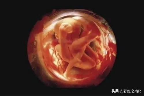 为什么有人说宝宝的胎毛要保留起来？有什么作用？插图27