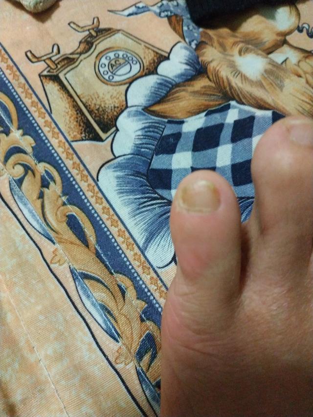 鲜卑族的脚趾头图片