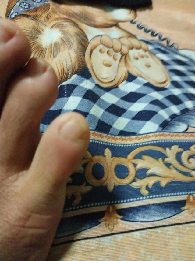 蒙古人种小脚趾甲图片