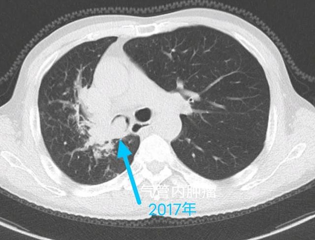 癌症从一开始就已经决定一个人的命运，治和不治都一样，是真的吗？插图4