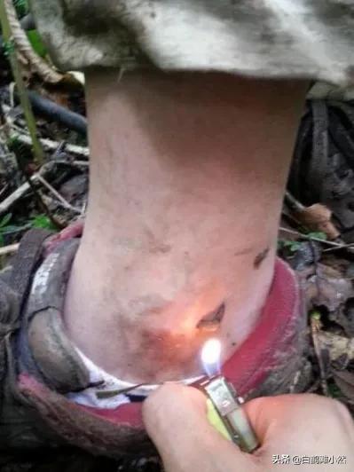 被山蛩虫咬了有没有毒:中医如何治疗虫咬性皮炎？