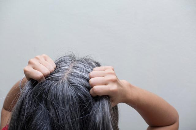 讨论什么方法能让白发转黑发？插图1