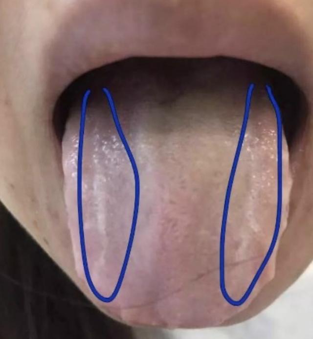 舌头胖大有齿痕，需要怎么调理？插图8