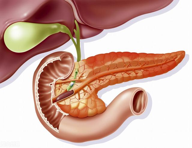 急性胰腺炎的治疗:急性胰腺炎治愈后血糖高该如何治疗？