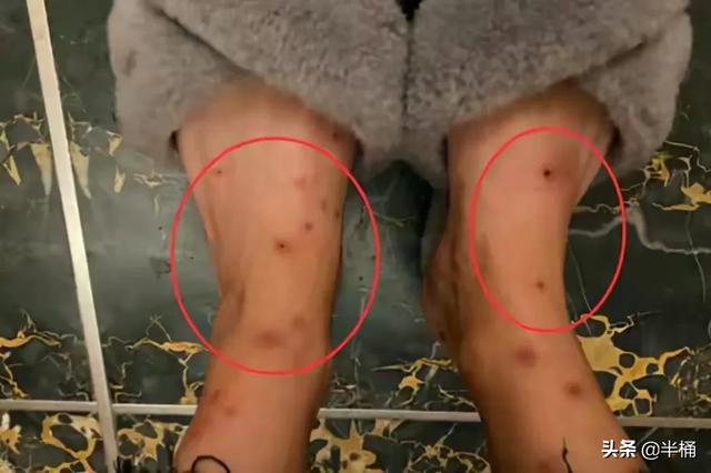 跳蚤怕什么天气:跳蚤怕什么气味 跳蚤怕水啊还是怕高温啊？