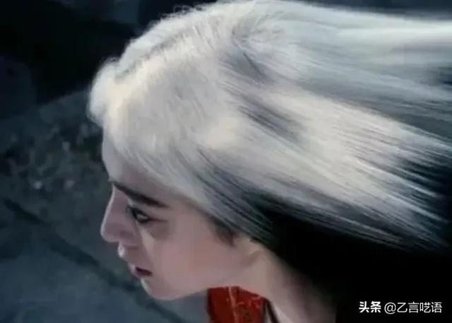 不想看见白发，又不想染发咋办？插图5