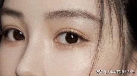 双眼皮内眼角拆线多少钱:做完切开双眼皮＋开内眼角拆线后有必要搽一些抗疤痕的药吗？