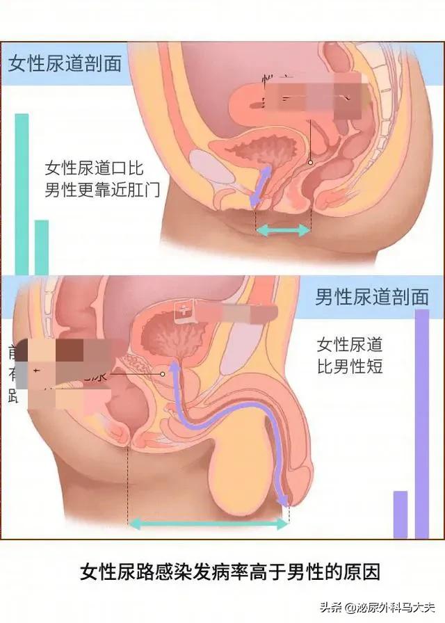 尿道疾病女性:尿道结石会引起妇科病吗？