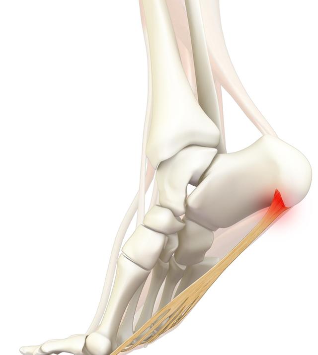 头条问答 足底筋膜炎有什么好的治疗方法吗 能量制导技术工作室的回答 0赞