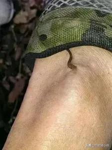 被山蛩虫咬了有没有毒:中医如何治疗虫咬性皮炎？