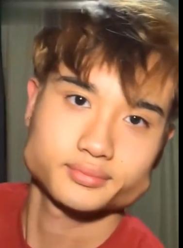 吃槟榔,腮帮子咬肌都练起来了,把脸型都嚼变形了,要怎么样才能恢复?