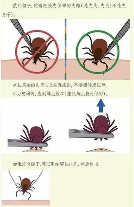 猫蜱虫叮咬后伤口图片:河南信阳3人因蜱虫病逝，曾为去世者穿寿衣，夺命蜱虫如何自救？