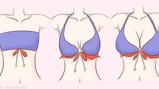 医生指导：真正有效的丰胸方法只有这一个