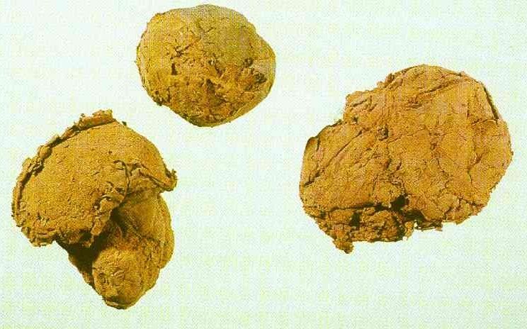 马勃不是马脖子,那是啥?可能很多人都不知道!