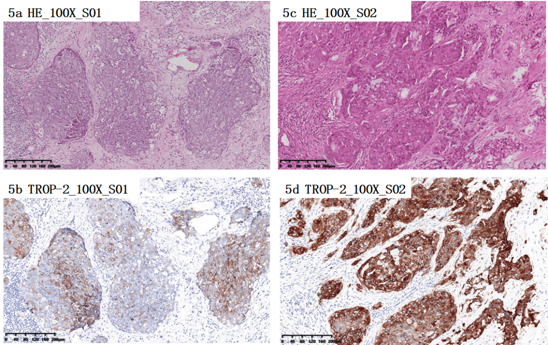 Why is immunohistochemistry preferred for TROP-2 ADC companion ...